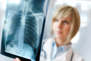Doctor Looking at X-Ray